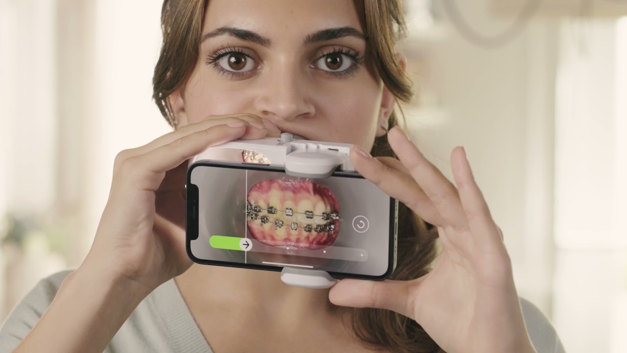 Dental Monitoring aplikacja